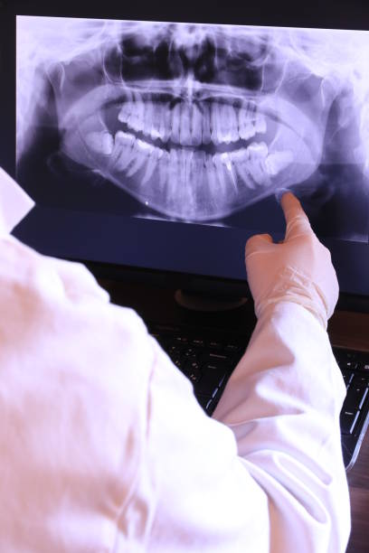 Best Emergency Root Canal Treatment in Malone, FL