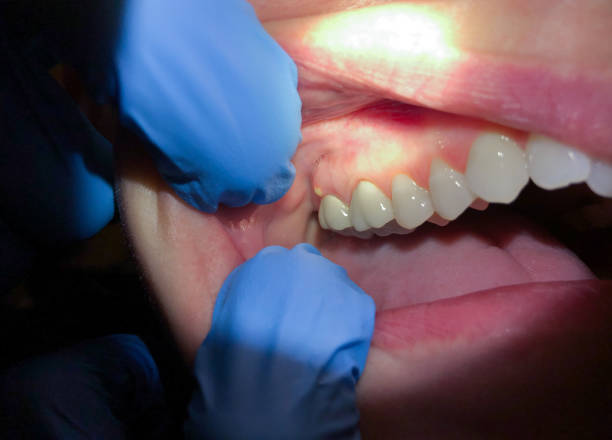 Best Pediatric Emergency Dentist in Malone, FL