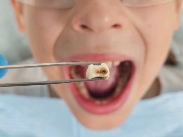 Best Same-Day Emergency Dentist in Malone, FL