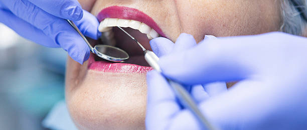 Best 24-Hour Emergency Dentist in Malone, FL